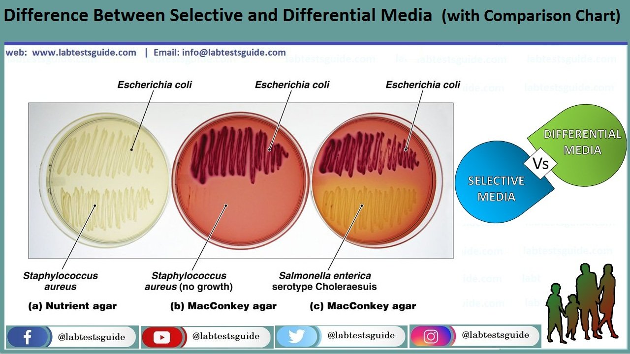 examples of microbiology culture media chart for effective use