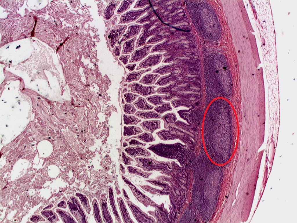 examples of peyers patches and their functions