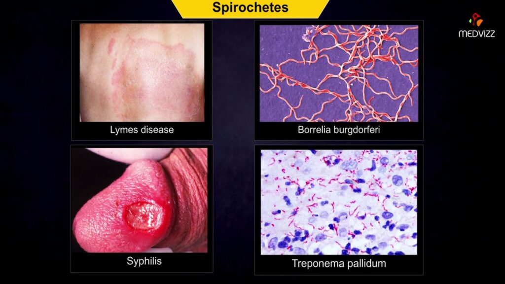 examples of spirochetes their role in health and ecosystems