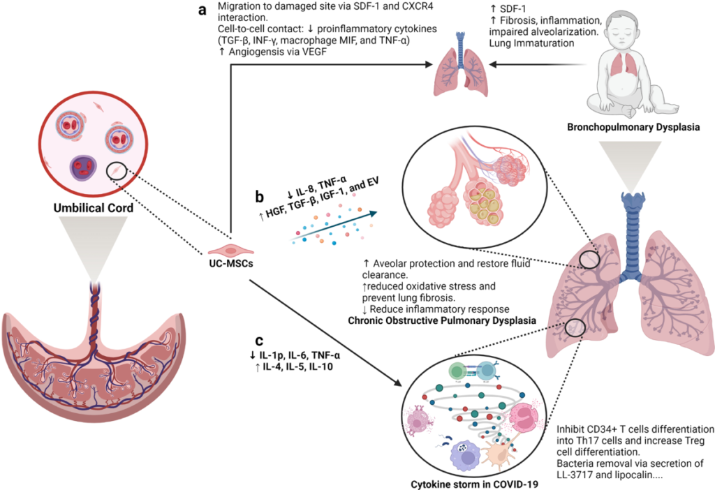 examples of stem cell therapy in modern medicine