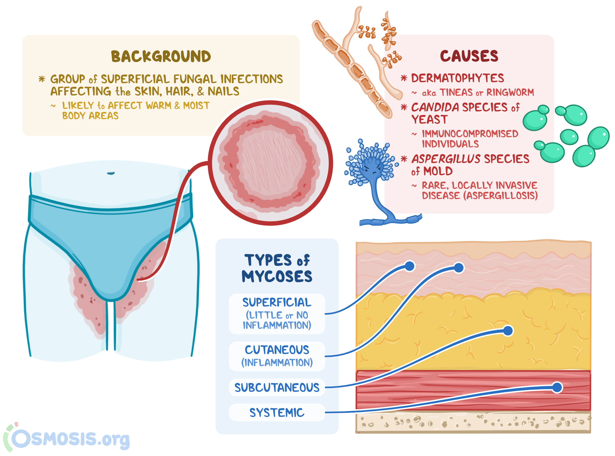 examples of superficial mycoses key insights explained