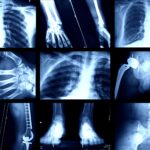 examples of x rays in medicine and industry