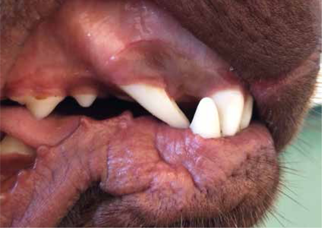 malocclusions examples and key exceptions