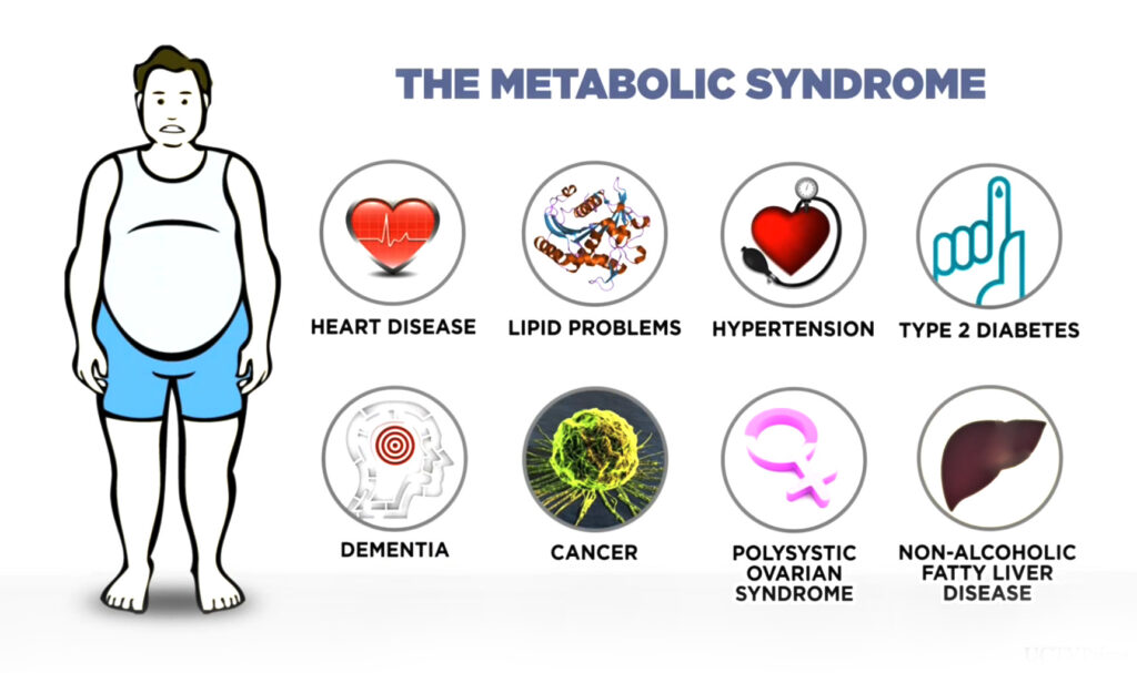 metabolic disorders examples and impact