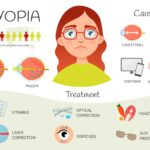 Myopia: Causes, Symptoms, and Treatment Options myopia causes symptoms and treatment options