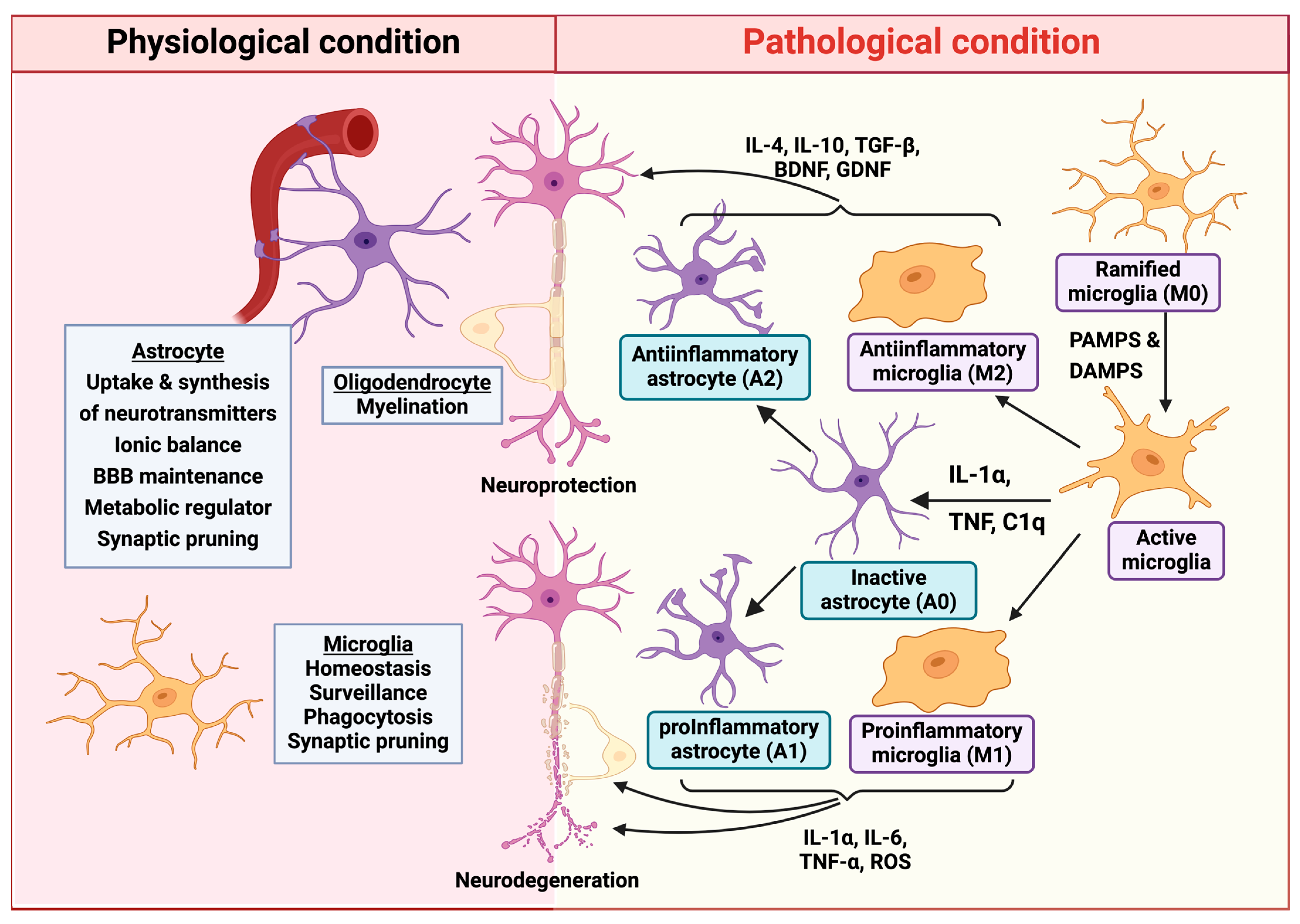 neurodegenerative diseases key examples explained