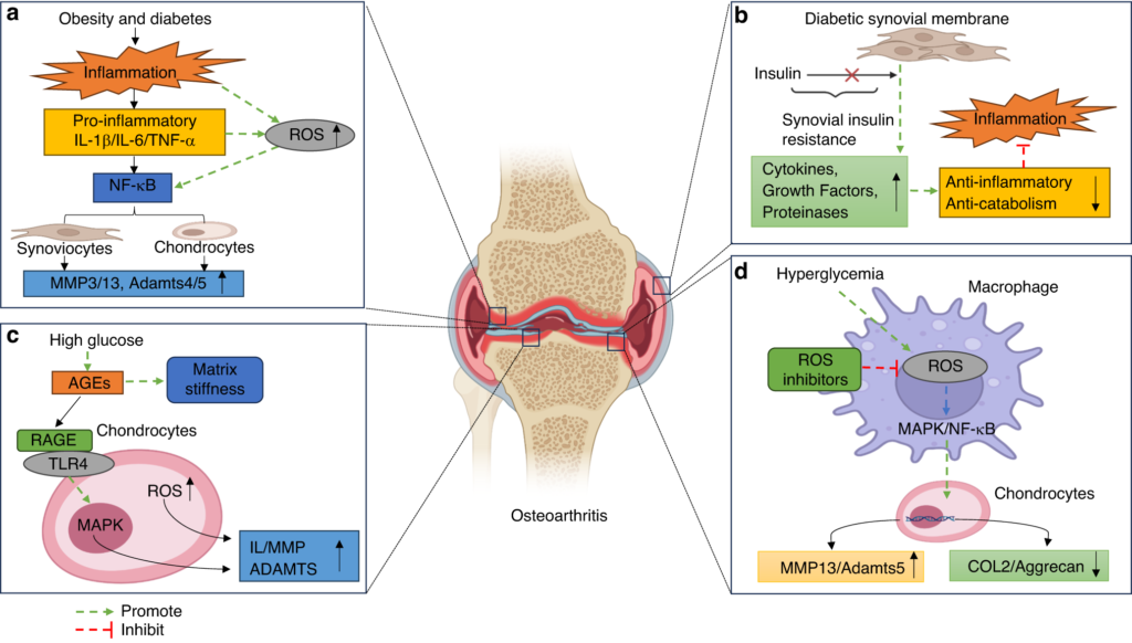 osteoarthritis and diabetes are examples of chronic conditions