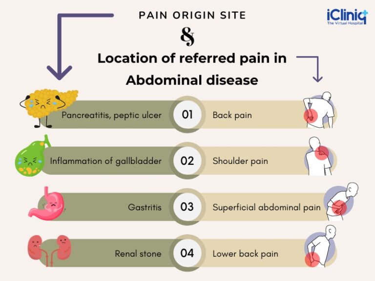 Referred Pain Examples and Their Health Implications