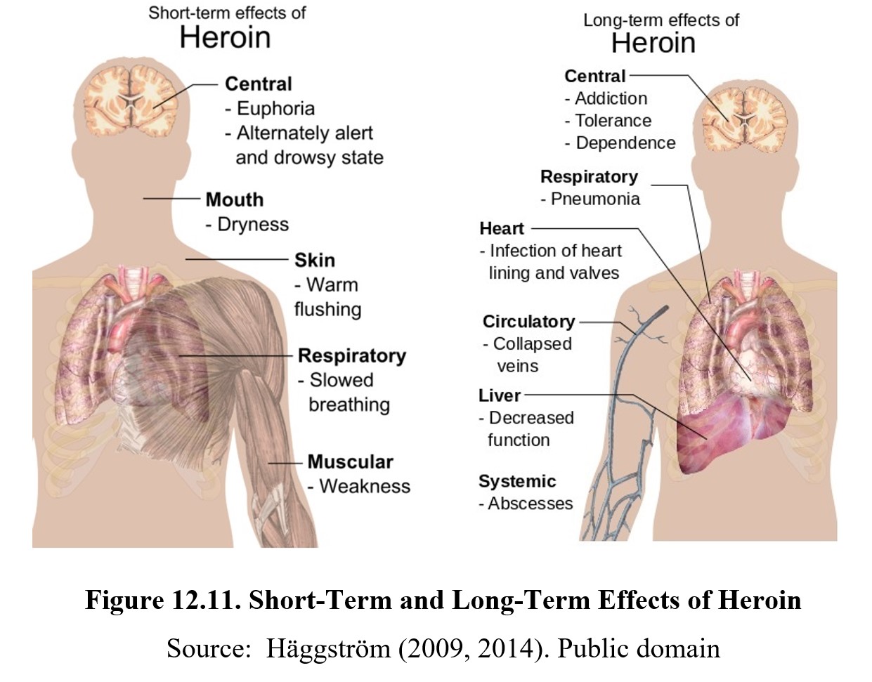 short term effects of opioids key examples