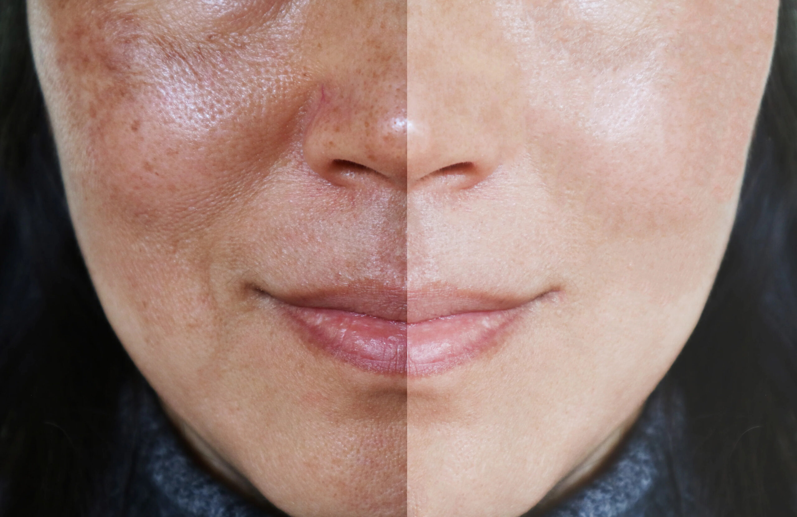 solutions for uneven skin tone you should try