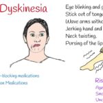 Tardive Dyskinesia: Symptoms and Treatment Examples tardive dyskinesia symptoms and treatment examples