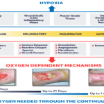 Types of Chronic Wounds and Their Care types of chronic wounds and their care