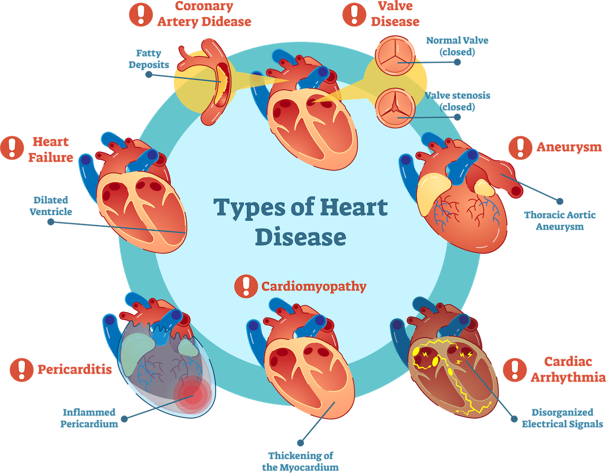 types of heart disease and their symptoms