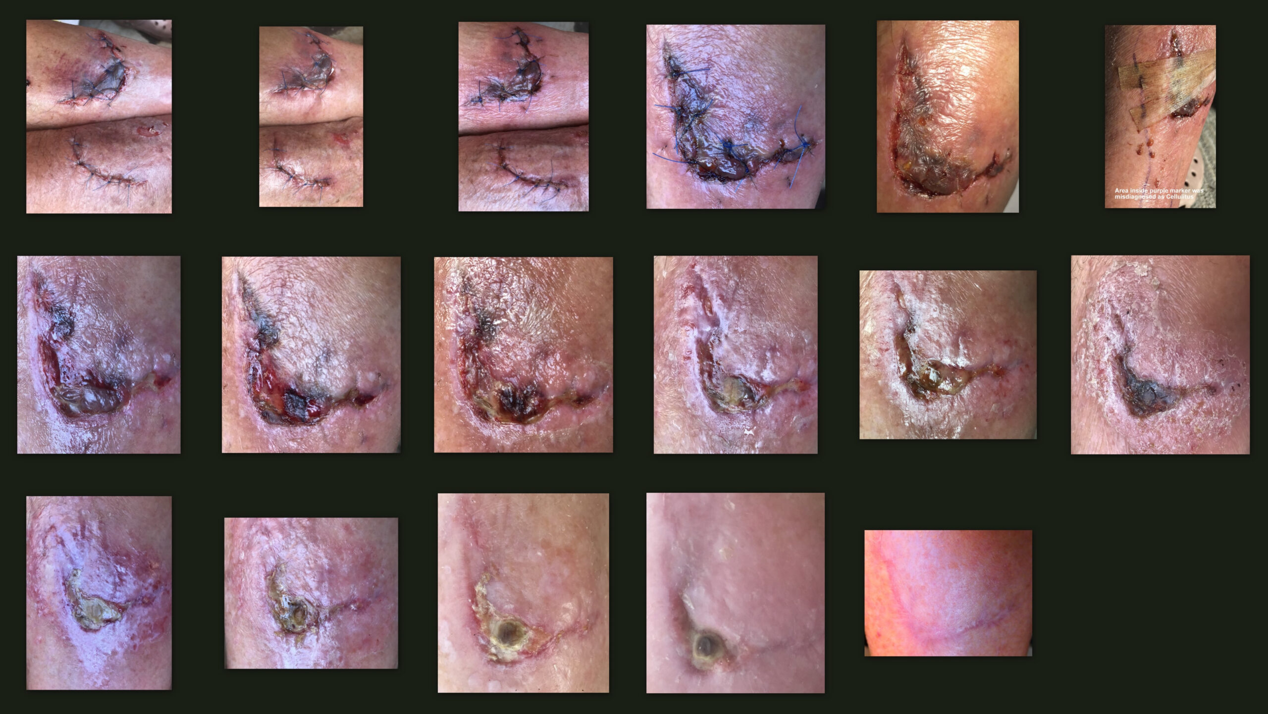 types of wound healing key examples explained scaled