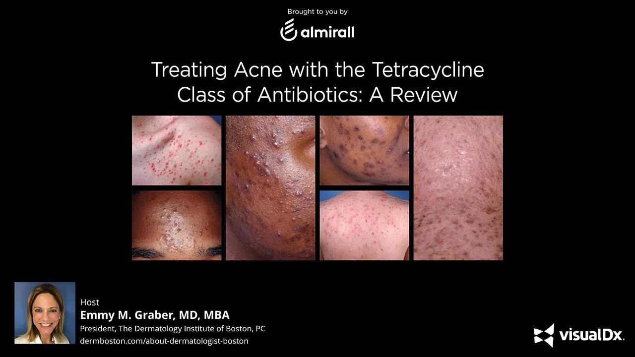 uses and examples of tetracycline in medicine
