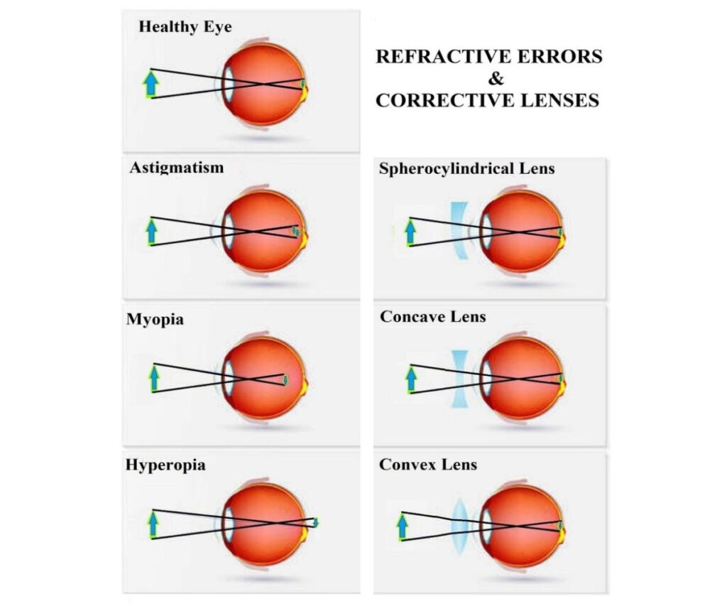 what a convex lens does in everyday use