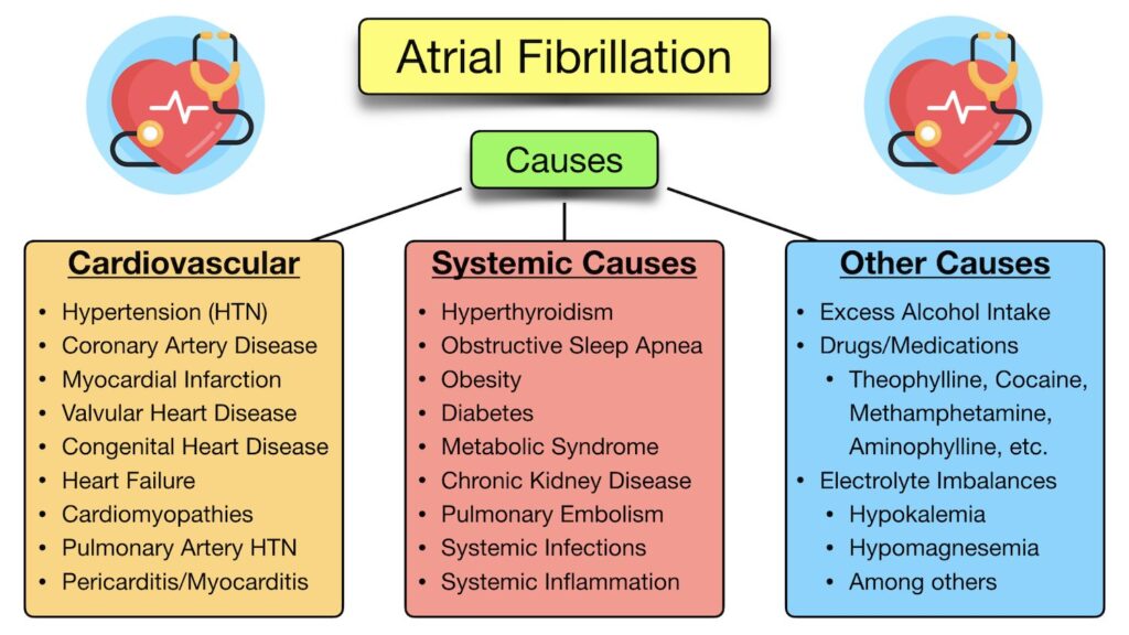 what is afib symptoms causes and treatments