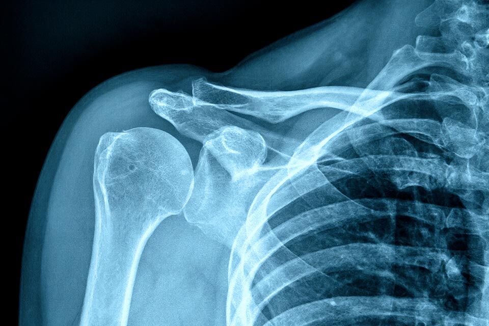 x ray applications in medicine and beyond