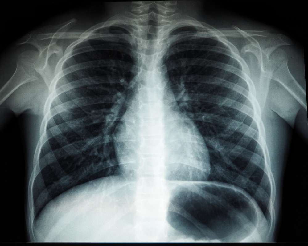 x ray examples for effective health diagnosis