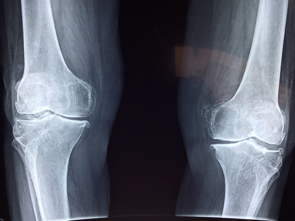 x ray waves examples in medicine and industry